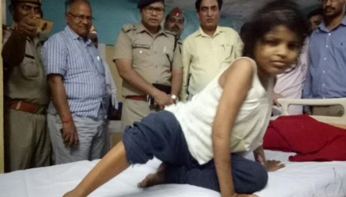 जंगलात सापडली ‘मोगली गर्ल’,  माकडांसोबत राहिली 10 वर्ष